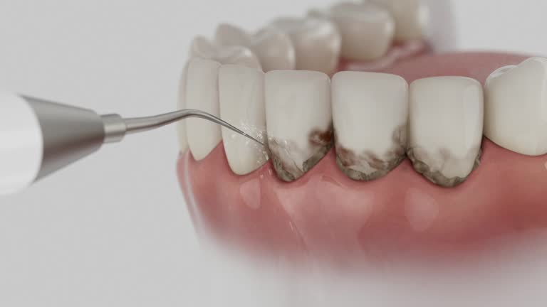 Trusted Wisdom Tooth Removal service in Bruceton, TN - Dentist Open Now